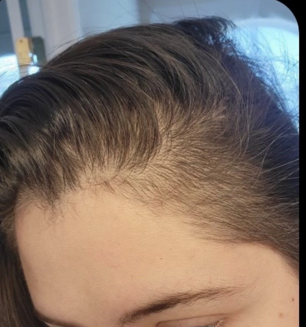 After