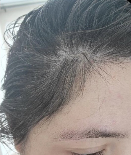 After