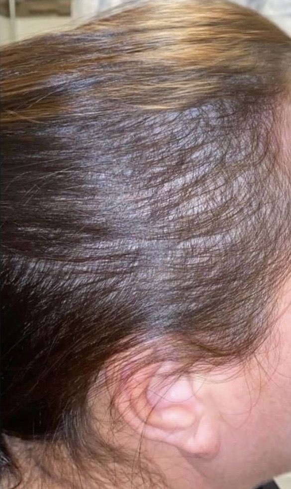 After — 10/27/20