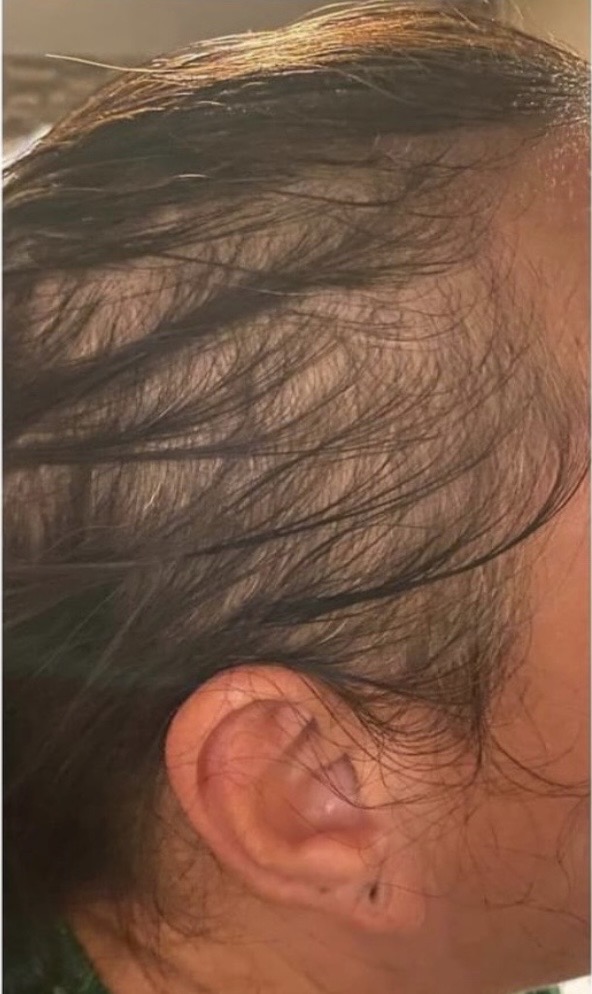 Before — 10/18/20